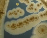 mycobacterium colonies mycobacterium colonies